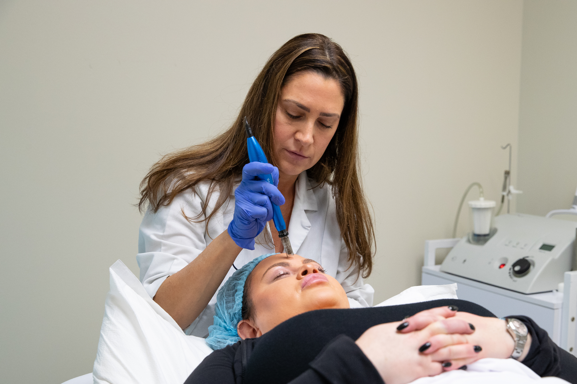 Microneedling 