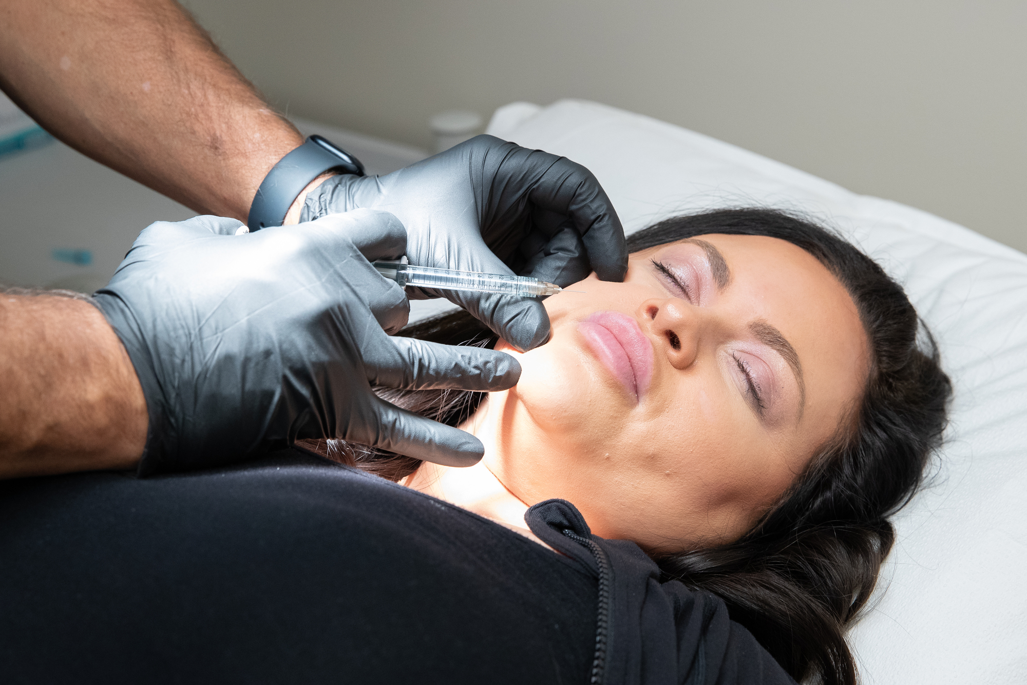 Facial FIllers